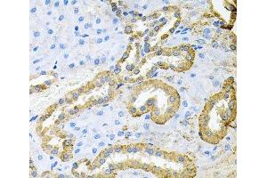 Immunohistochemistry of paraffin-embedded Rat kidney using ABL1 Polyclonal Antibody at dilution of 1:100 (40x lens).