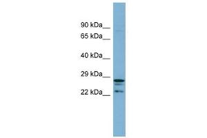 Image no. 1 for anti-CutC Copper Transporter Homolog (CUTC) antibody (ABIN632334)
