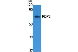 Image no. 1 for anti-Pyruvate Dehyrogenase Phosphatase Catalytic Subunit 2 (PDP2) (Internal Region) antibody (ABIN3187635)