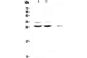 Image no. 1 for anti-MAX Dimerization Protein 1 (MXD1) (AA 1-221) antibody (ABIN5692892)