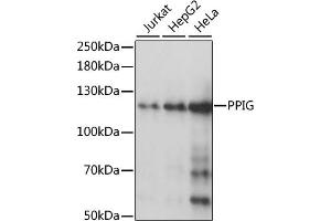 Western blot analysis of extracts of various cell lines, using PPIG antibody (ABIN1513403, ABIN3020977, ABIN3020978 and ABIN6213843) at 1:1000 dilution.