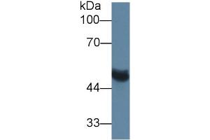 Image no. 3 for Matrix Metallopeptidase 13 (Collagenase 3) (MMP13) ELISA Kit (ABIN6730942)