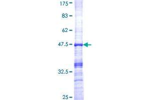 TNNI3 Protein (AA 102-210) (GST tag)