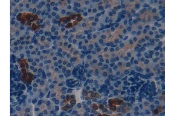 S100A8 antibody  (AA 1-89)