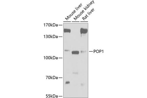 POP1 antibody  (AA 1-210)