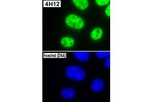 Image no. 3 for anti-Small Nuclear Ribonucleoprotein Polypeptide C (SNRPC) antibody (ABIN5588484)