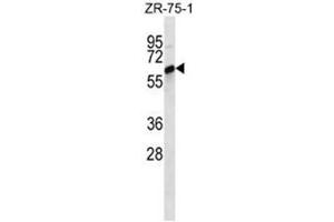 Image no. 1 for anti-ATP-Binding Cassette, Sub-Family G (WHITE), Member 4 (ABCG4) (AA 43-73), (N-Term) antibody (ABIN950209)
