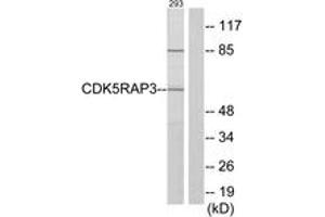 Image no. 1 for anti-CDK5 Regulatory Subunit Associated Protein 3 (CDK5RAP3) (AA 341-390) antibody (ABIN1534334)