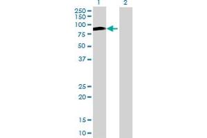 Image no. 3 for anti-UTP3, Small Subunit (SSU) Processome Component (UTP3) (AA 1-479) antibody (ABIN528075)