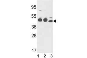Western blot analysis of Cytokeratin-18 antibody and (1) K562, (2) NCI-H460, and (3) mouse stomach lysate.