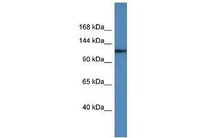 Image no. 1 for anti-Ubiquitin Specific Peptidase 6 (USP6) (C-Term) antibody (ABIN2788027)