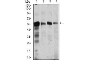 Image no. 2 for anti-Calcium/calmodulin-Dependent Protein Kinase IV (CAMK4) (AA 35-292) antibody (ABIN1845379)
