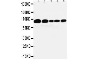 Image no. 1 for anti-Paxillin (PXN) (AA 305-559), (C-Term) antibody (ABIN3043666)