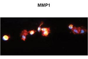 Image no. 3 for anti-Matrix Metallopeptidase 1 (Interstitial Collagenase) (MMP1) (C-Term) antibody (ABIN2777120)