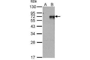 WB Image Western Blot analysis of NR4A1 expression in transfected 293T cell line by NR4A1 polyclonal antibody.