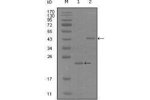EPH Receptor A8 antibody  (AA 70-150)