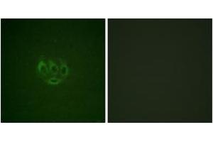 Immunofluorescence analysis of A549 cells, using ACK1 (Phospho-Tyr284) Antibody.