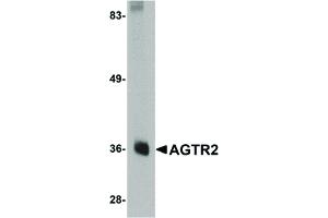 Image no. 1 for anti-Angiotensin II Receptor, Type 2 (AGTR2) (Internal Region) antibody (ABIN6656108)