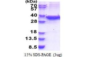 Image no. 1 for Sirtuin 5 (SIRT5) (AA 34-310) protein (His tag) (ABIN5853379)
