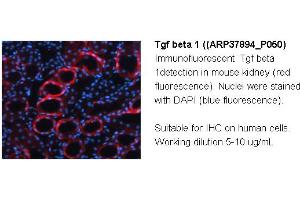 Image no. 2 for anti-Transforming Growth Factor, beta 1 (TGFB1) (Middle Region) antibody (ABIN2780306)
