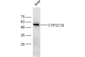 Image no. 1 for anti-Cytochrome P450, Family 2, Subfamily C, Polypeptide 18 (CYP2C18) (AA 401-490) antibody (ABIN5675365)
