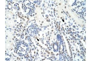 Image no. 1 for anti-Pogo Transposable Element with ZNF Domain (POGZ) (N-Term) antibody (ABIN925917)