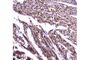 Image no. 4 for anti-Nuclear Factor I/B (NFIB) antibody (ABIN5692906)
