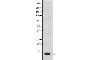 Image no. 2 for anti-Chemokine (C-X-C Motif) Ligand 11 (CXCL11) (Internal Region) antibody (ABIN6261120)