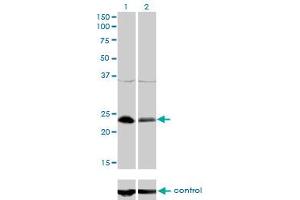 Image no. 1 for anti-Nuclear Transcription Factor Y, beta (NFYB) (AA 1-207) antibody (ABIN561992)