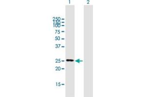 Image no. 1 for anti-Folliculogenesis Specific Basic Helix-Loop-Helix (FIGLA) (AA 1-219) antibody (ABIN949951)