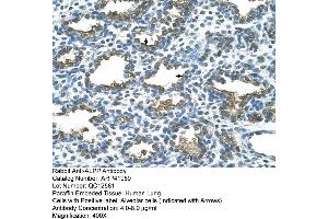 Image no. 2 for anti-Placental Alkaline Phosphatase (ALPP) (C-Term) antibody (ABIN2777088)