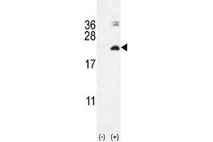 Image no. 2 for anti-Interleukin 17F (IL17F) (AA 16-45) antibody (ABIN3031459)