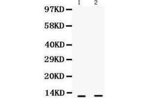 Image no. 3 for anti-S100 Calcium Binding Protein A6 (S100A6) (AA 1-90) antibody (ABIN3043320)
