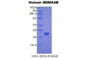 Image no. 1 for Sema Domain, Immunoglobulin Domain (Ig), Transmembrane Domain (TM) and Short Cytoplasmic Domain, (Semaphorin) 4B (SEMA4B) (AA 192-367) protein (His tag) (ABIN1877886)