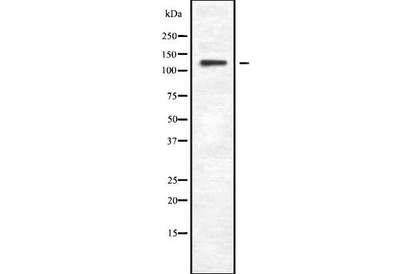 Phospholipase C beta 4 antibody  (Internal Region)