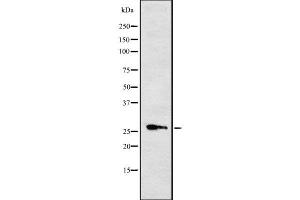 CYB561 antibody  (Internal Region)