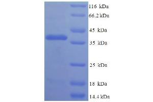 Image no. 1 for Fin Bud Initiation Factor Homolog (FIBIN) (AA 19-211) protein (His-SUMO Tag) (ABIN5711684)