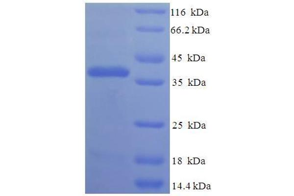 FIBIN Protein (AA 19-211) (His-SUMO Tag)