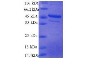 Image no. 1 for Ribosomal Protein S10 (RPS10) (AA 4-165), (partial) protein (GST tag) (ABIN1607982)