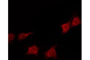 Image no. 4 for anti-14-3-3 zeta (YWHAZ) (pSer58) antibody (ABIN6256377)