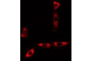 Image no. 3 for anti-Cytochrome B5 Type A (Microsomal) (CYB5A) (Internal Region) antibody (ABIN6261133)