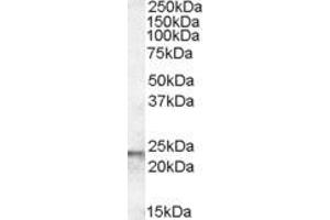 Image no. 5 for anti-Transgelin (TAGLN) (C-Term) antibody (ABIN185188)