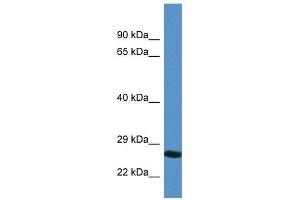 Image no. 1 for anti-Yip1 Domain Family, Member 4 (YIPF4) (N-Term) antibody (ABIN926526)