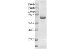 Image no. 1 for Protein Arginine Methyltransferase 3 (PRMT3) protein (DYKDDDDK Tag) (ABIN2669673)
