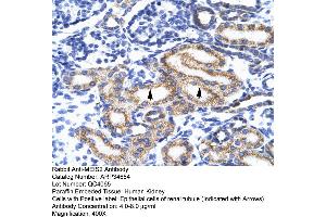 Image no. 2 for anti-Meis Homeobox 2 (MEIS2) (N-Term) antibody (ABIN2775951)