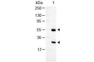 Image no. 3 for Rabbit anti-Goat IgG (Heavy & Light Chain) antibody (Alkaline Phosphatase (AP)) - Preadsorbed (ABIN101206)