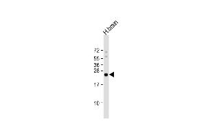 RHOB anticorps  (AA 104-137)