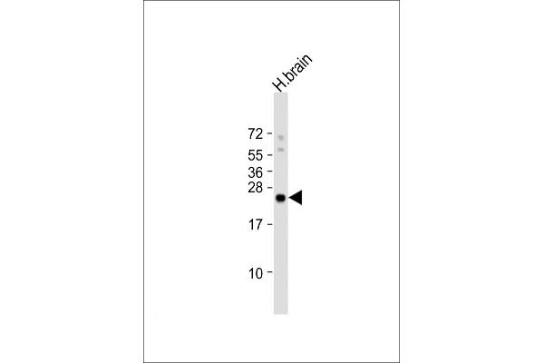 RHOB anticorps  (AA 104-137)