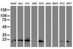 Image no. 2 for anti-Ubiquitin-Conjugating Enzyme E2E 3 (UBE2E3) antibody (ABIN1501628)