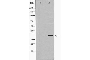Image no. 1 for anti-Carbonic Anhydrase I (CA1) (Internal Region) antibody (ABIN6260376)